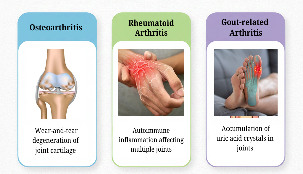 Types of Arthritis
